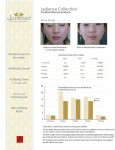 Acne - Before & After